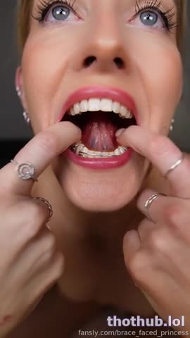 Brace Faced Princess: Taped Shut